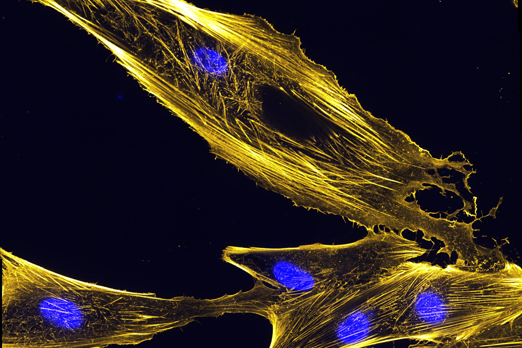 In Vitro Muskelzellen
